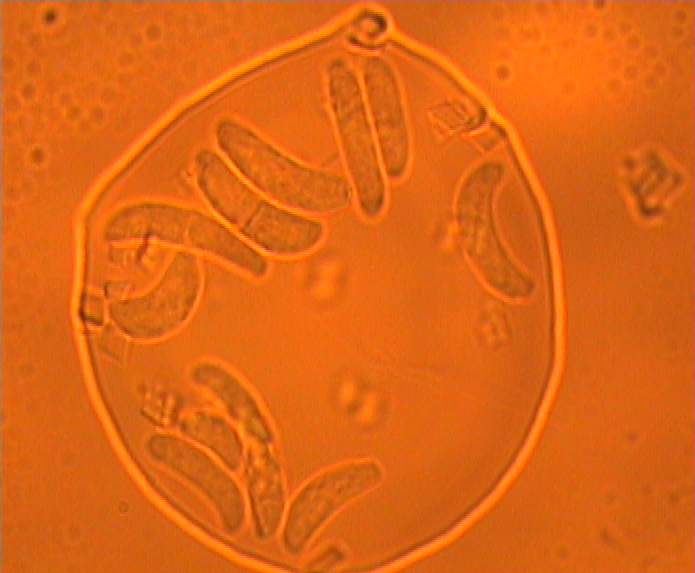 Pilze in Wasserprobe